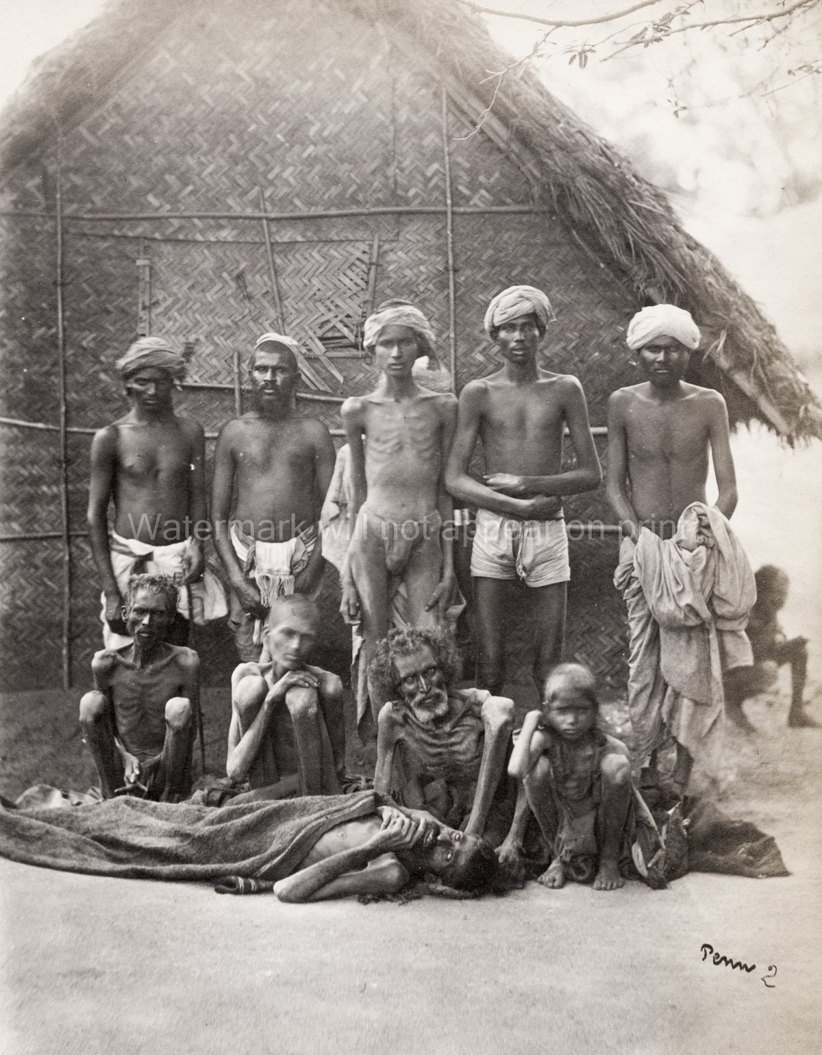 Indian Famine Victims Starving Emaciated Group Hut India Vtg. Photo 19thC.