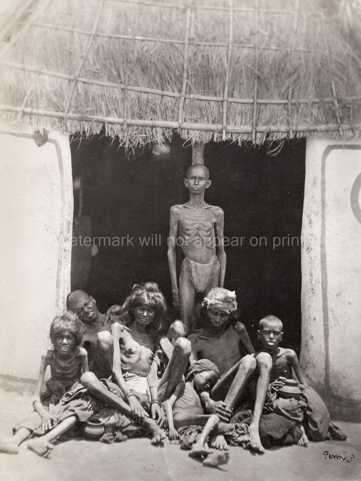 India Famine Victims Starvation Poverty Emaciated People Hut Vtg. Photo 19thC.